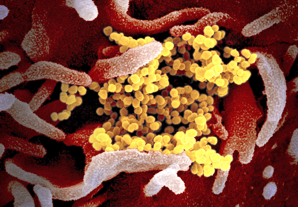 COURTESYNATIONAL INSTITUTE OF ALLERGY AND INFECTIOUS DISEASES ROCKY MOUNTAIN LABORATORIES VIA THE ASSOCIATED PRESS